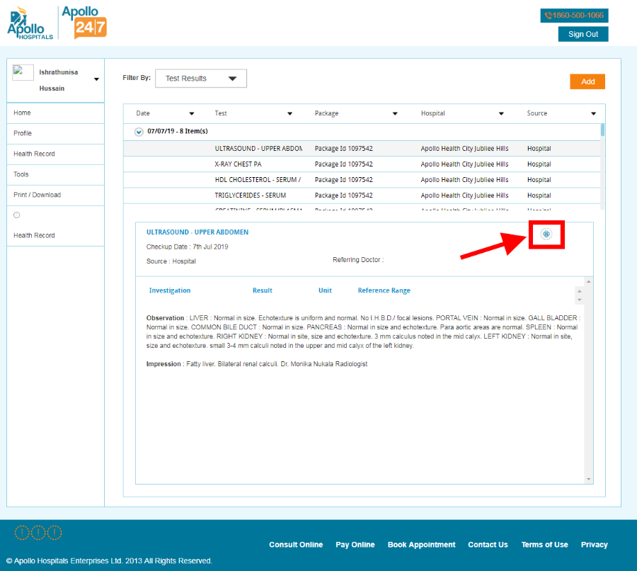 Download Reports from Apollo Diagnostics